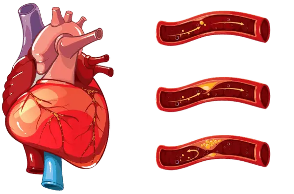 cardiopatia-isquemica--clinica-de-insuficiencia-cardiaca