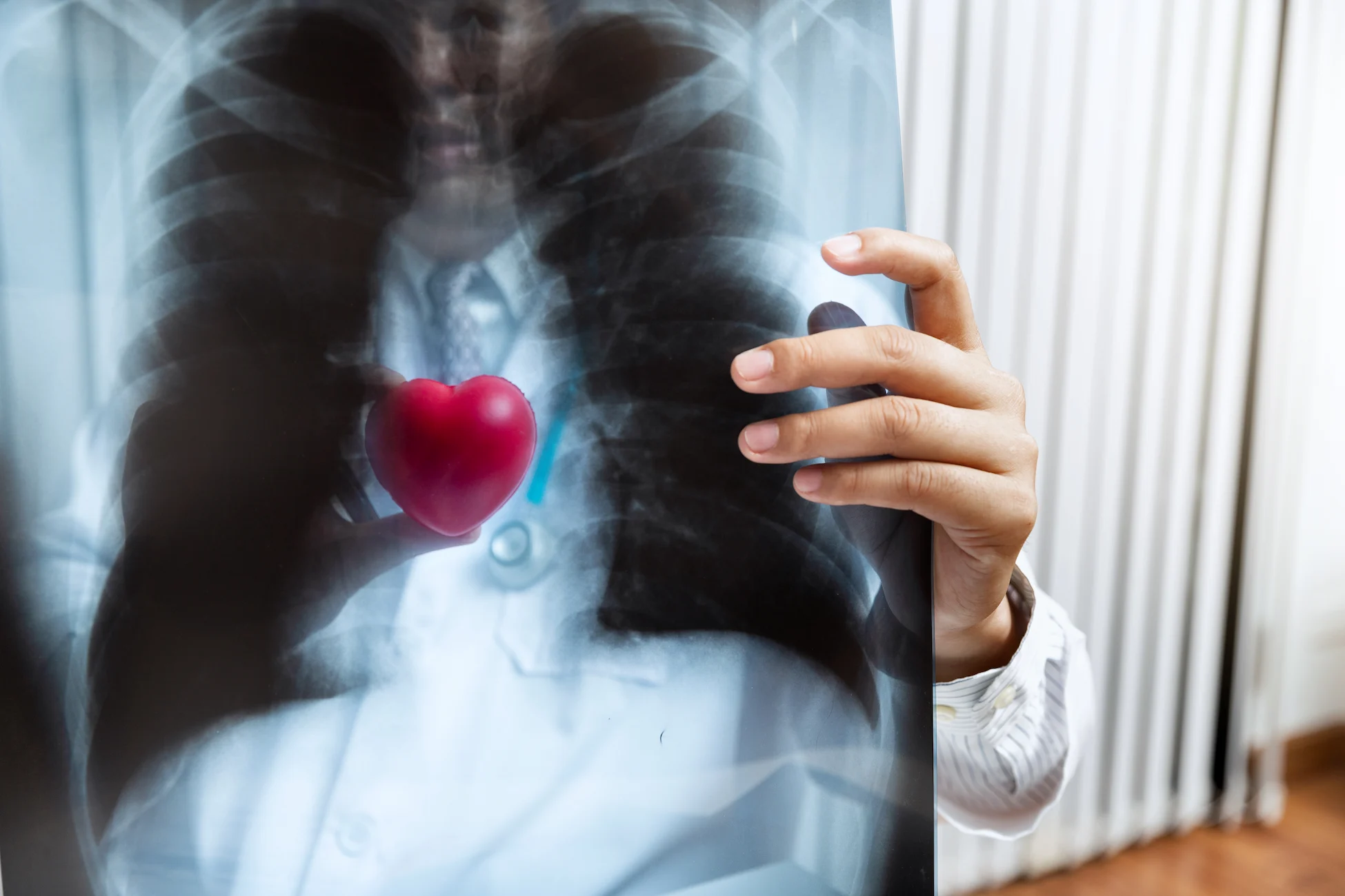Cardiopatia isquemica en el corazon - clinica de cardiologia avanzada